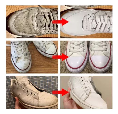 ¡Tus Zapatos Como Nuevos en Segundos! 🔥 Sin Esfuerzo y con Resultados WOW